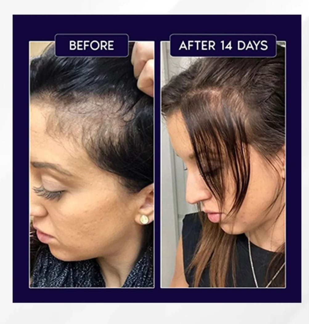 FEG PLUS Hair Growth Spray 50ml